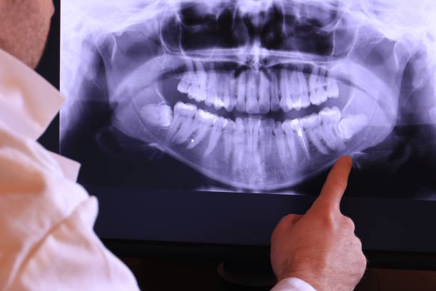 Best Emergency Treatment for Oral Infections in Sunnyvale, TX